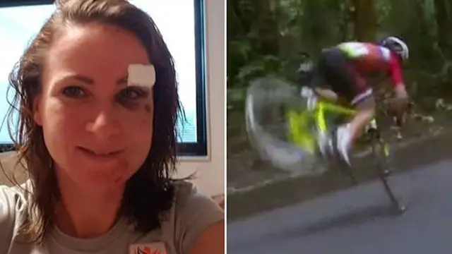6 Atlet yang Alami Cedera Serius di Olimpiade Rio Bikin Ngilu