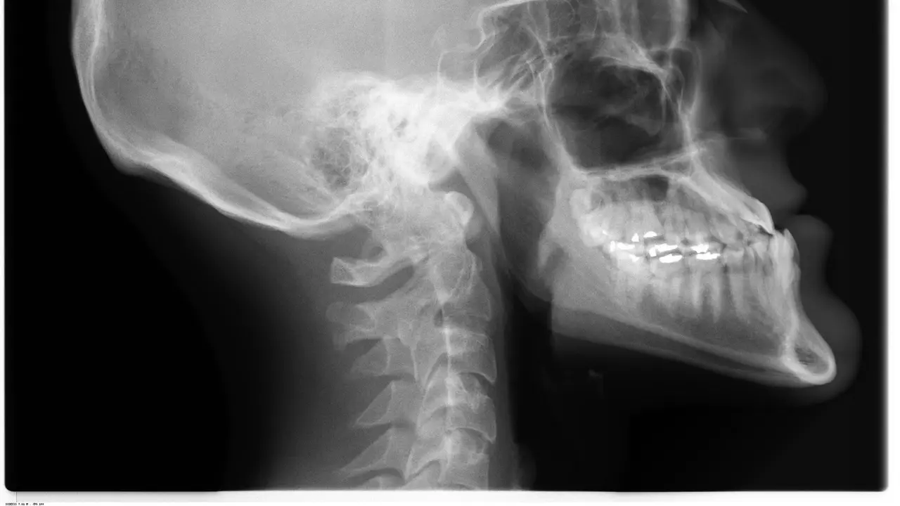Ilustrasi Radiologi
