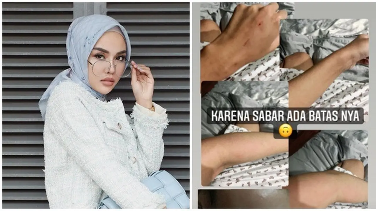 Diduga Alami KDRT oleh Suami, Ini 4 Fakta yang Dibongkar Medina Zein