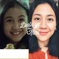 Dulu dan kini perubahan Sherina Munaf. (Istimewa, Instagram/sherinamunaf)