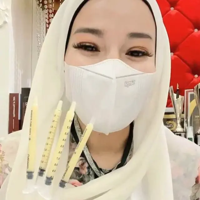 Perawatan Kecantikan Terbaru dengan Teknologi Biocell Filler