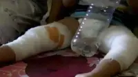 Balita Korban Penyanderaan Masih Trauma
