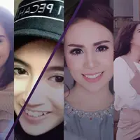 Sebagian orang mungkin merasa terganggu dengan gigi gingsul, namun tidak bagi 5 artis ini.