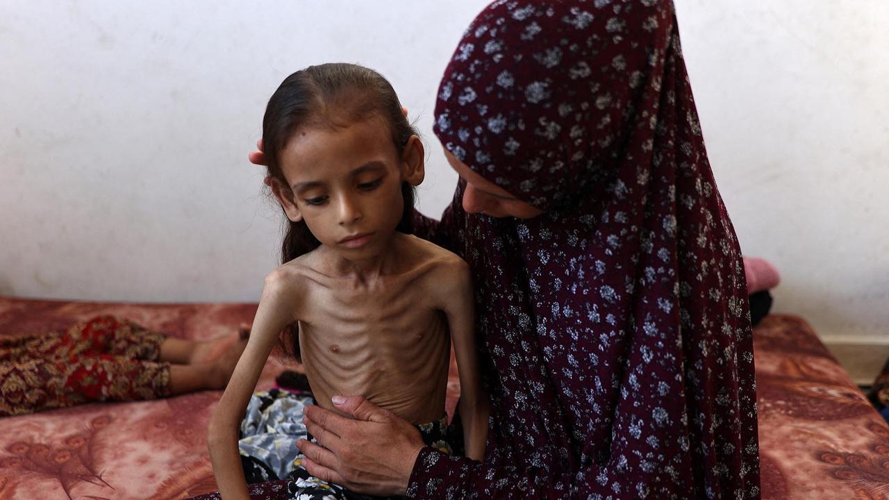 FOTO: Potret Pedih Mariam Anak 9 Tahun, Korban Kelaparan Gaza