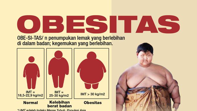 Arya Permana, salah satu contoh kasus obesitas yang mengkhawatirkan (liputan6.com/Tri yasni)