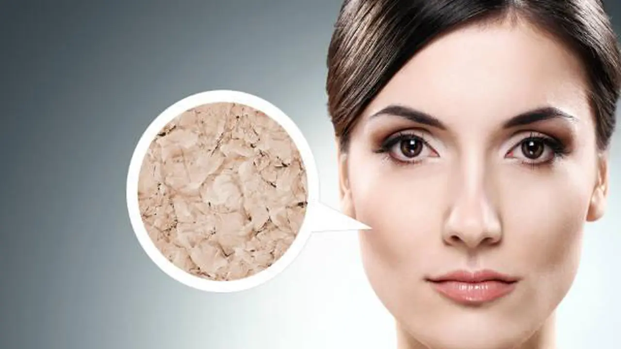 Kunjungi Dermatolog, Jika Kulit Mengalami 5 Tanda Ini