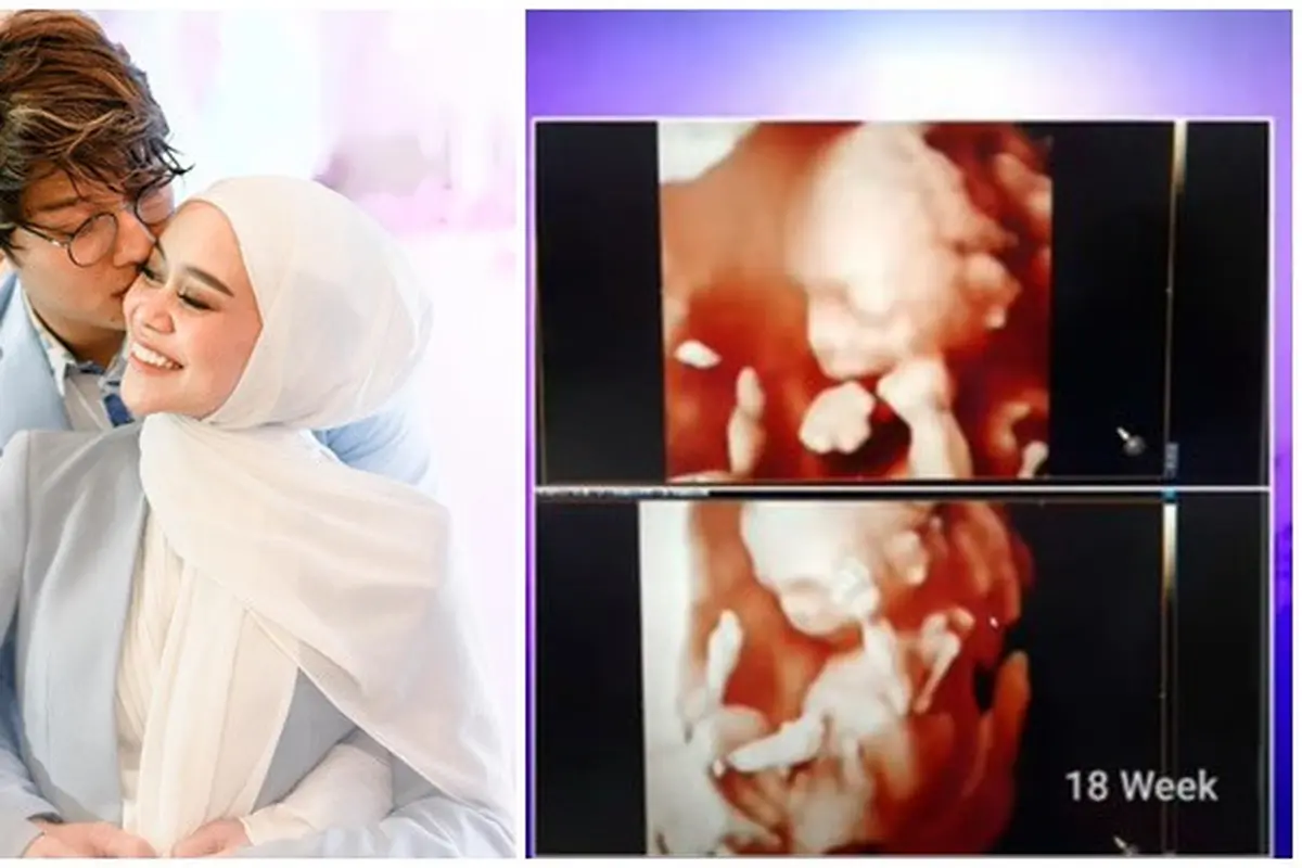 6 Potret Lesty Kejora Pamer Foto USG, Kini Usia Kandungan Sudah 6 Bulan