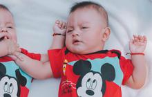 7 Fakta Anak Kembar yang Jarang Diketahui, Unik dan Menakjubkan