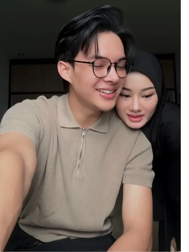 6 Potret Rey Mbayang Benarkan Dirinya Oplas Hidung, Mengaku Demi Kesehatan