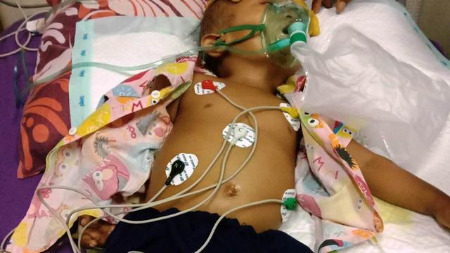 Balita 2 Tahun Penderita Kanker Tulang Asal Ogan Ilir Butuh Uluran Bantuan