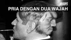 Bangsawan Inggris, Edward Mordake dimitoskan memiliki 2 wajah sungguhan. Sayangnya, ia harus mengakhiri hidupnya di usia 23 tahun 