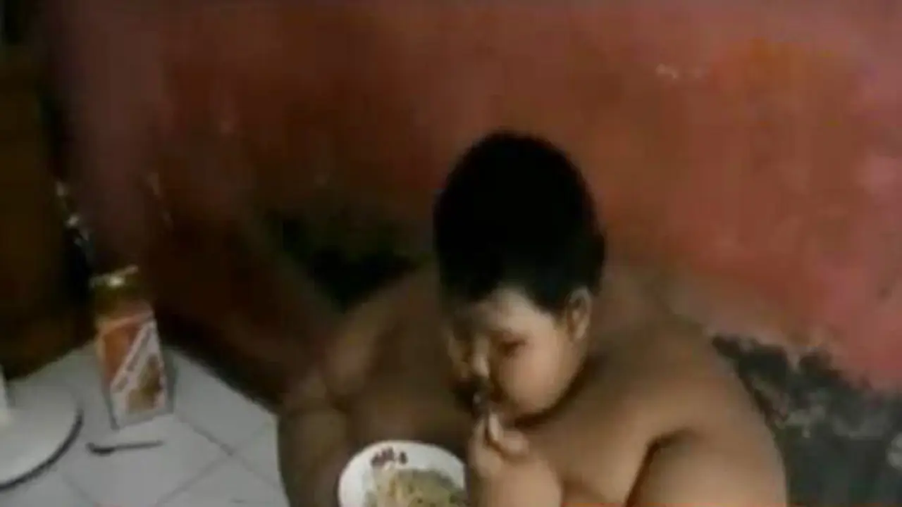 Bocah Obesitas Karawang