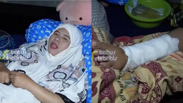 Pakai Kursi Roda, 6 Potret Terbaru Rohimah Alli Mantan Istri Kiwil Usai Kecelakaan