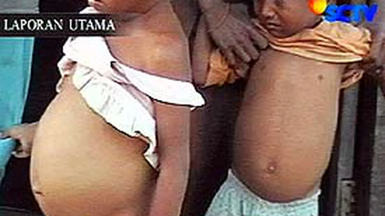 060605aBusungLapar.jpg