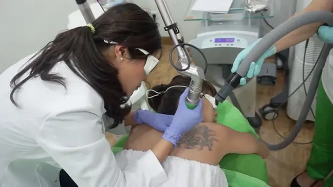Proses tattoo removal di ZAP Clinic/Foto: copyright ZAP Clinic