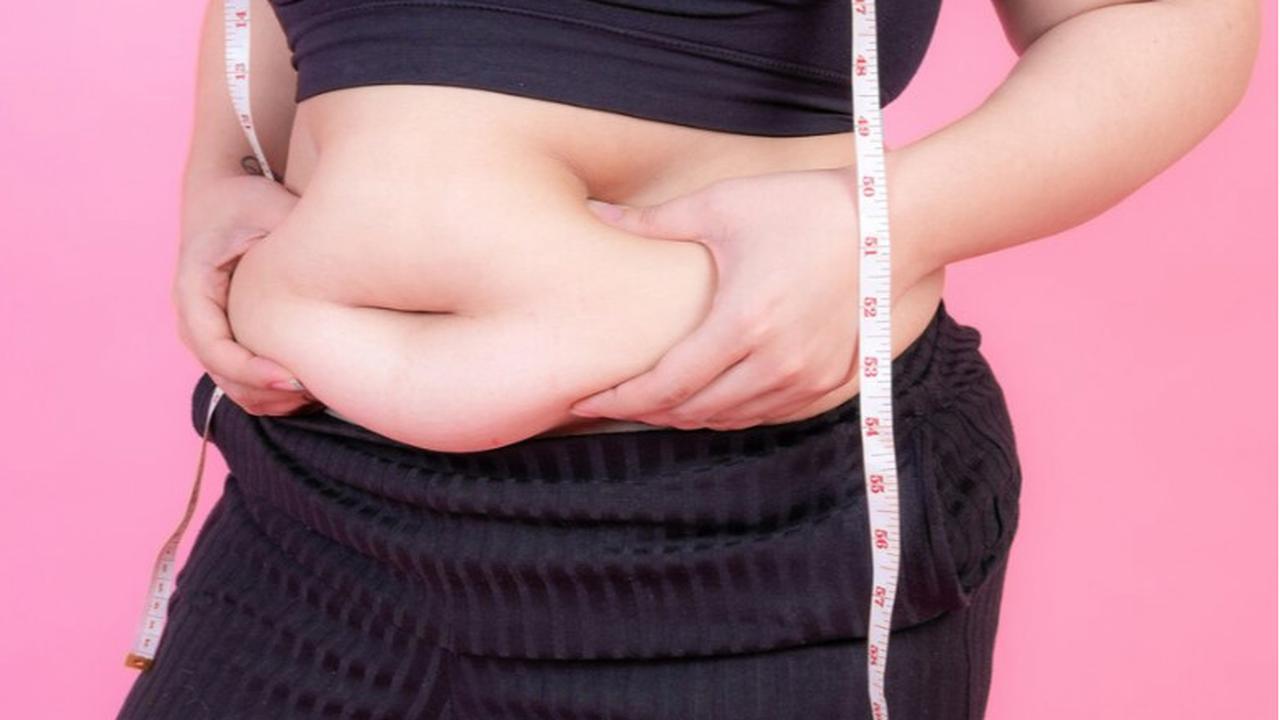 obesitas