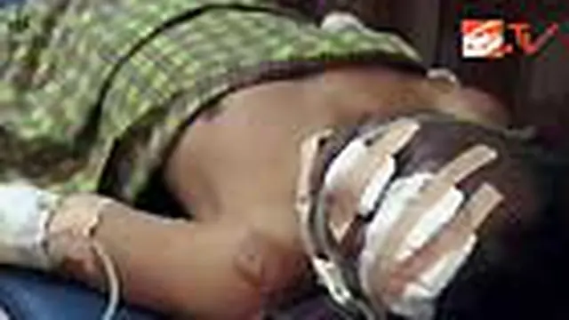 Seorang pedagang bakso di Sumedang, Jabar, menderita luka bakar serius akibat terkena ledakan tabung elpiji isi tiga kilogram yang bocor. 