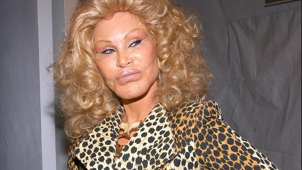 Jocelyn Wildenstein, Wanita Super Kaya yang Doyan Permak Wajah Bisnis