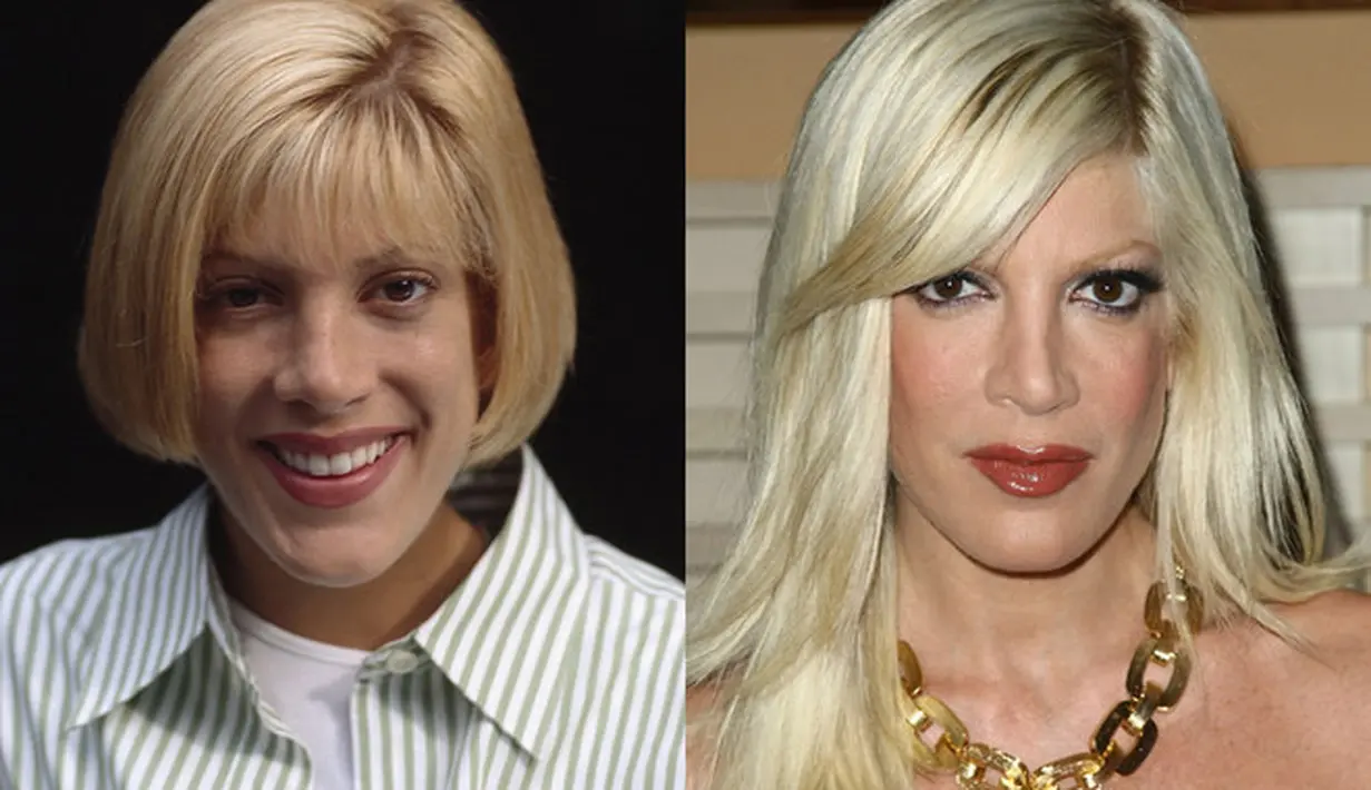 Pada tahun 2000, Tori Spelling mengaku melakukan operasi hidung. (Pinterest)