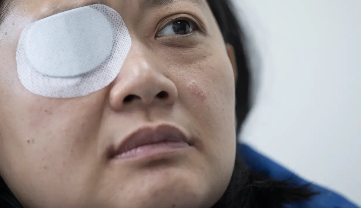 Jurnalis  Indonesia yang tertembak di Hong Kong, Veby Mega Indah saat wawancara dengan The Associated Press di distrik Wan Chai, 4 Desember 2019. Veby yang mengenakan tanda pengenal pers, rompi, helm, kacamata dan masker terkena peluru saat meliput aksi demo pada 29 September lalu (AP/Vincent Thian)