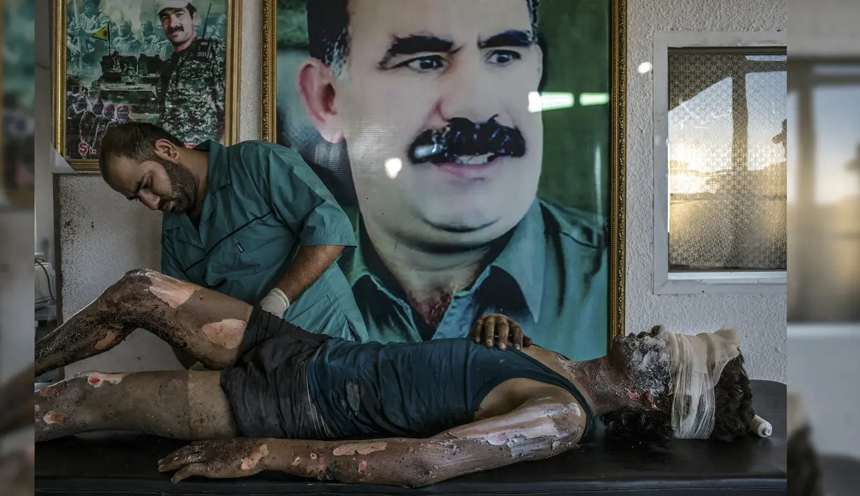 Dokter mengobati pejuang ISIS di depan poster Abdullah Ocalan di rumah sakit YPG, Hasakah (1/8/2015). Foto kategori General News karya Mauricio Lima berjudul 'IS Fighter Treated at Kurdish Hospital' menjadi pemenang '1st prize singles'. (Reuters via WPP)