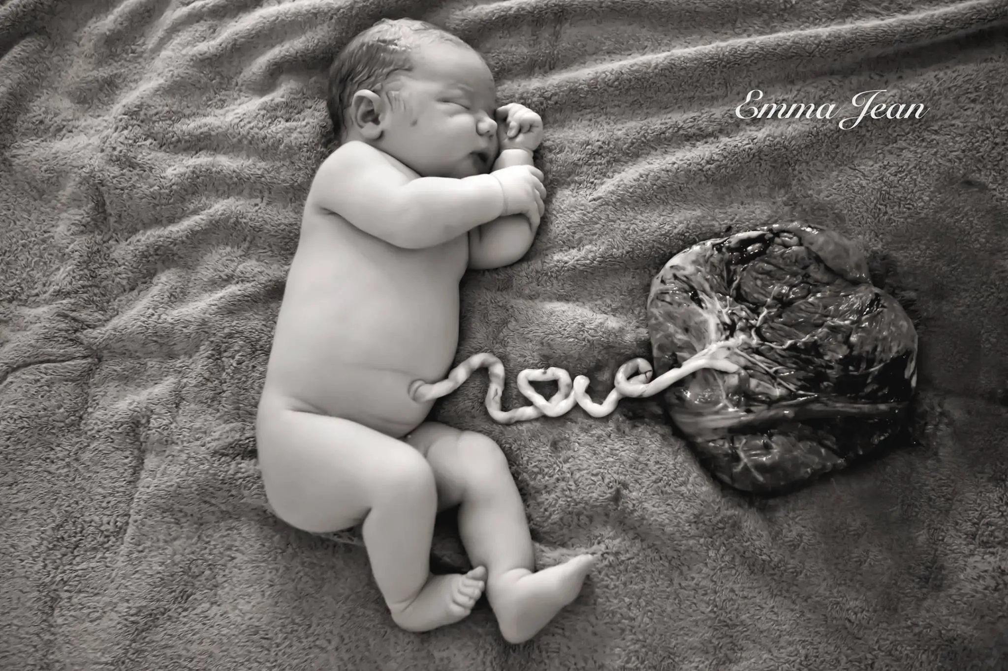 Sebelum dikubur, bidan cantik ini mengabadikan plasenta dan bayi dalam sebuah foto menyentuh hati.