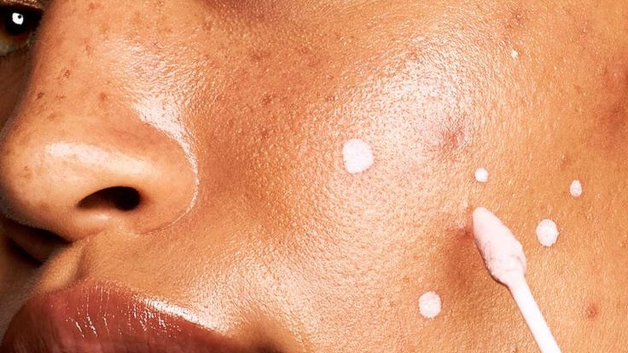 Punya Kulit Berjerawat? Simak Urutan Skincare Malam yang Paling Efektif untuk Hasil Maksimal