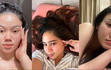 10 Potret Artis Tampil Percaya Diri Pamerkan Bare Face, Tetap Menawan Meski Wajah Penuh Jerawatan