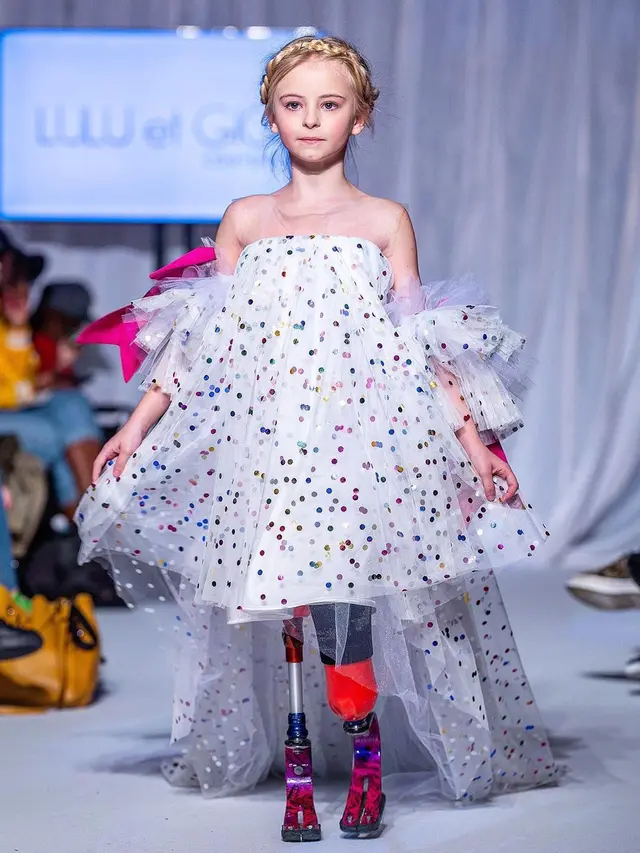 Daisy May, Model Cilik Disabilitas (sumber: instagram/@daisymay_demetre)