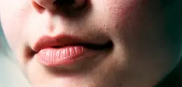 Jerawat yang sering muncul dapat membuat perawatan kulit terasa tidak pernah benar-benar efektif (Sumber: Pexels.com)