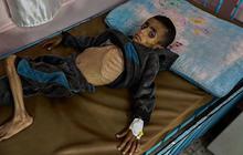 Kita Sedang Membuat Anak-anak Gaza Kelaparan, Kita Semua Bertanggung jawab Atas Situasi Ini