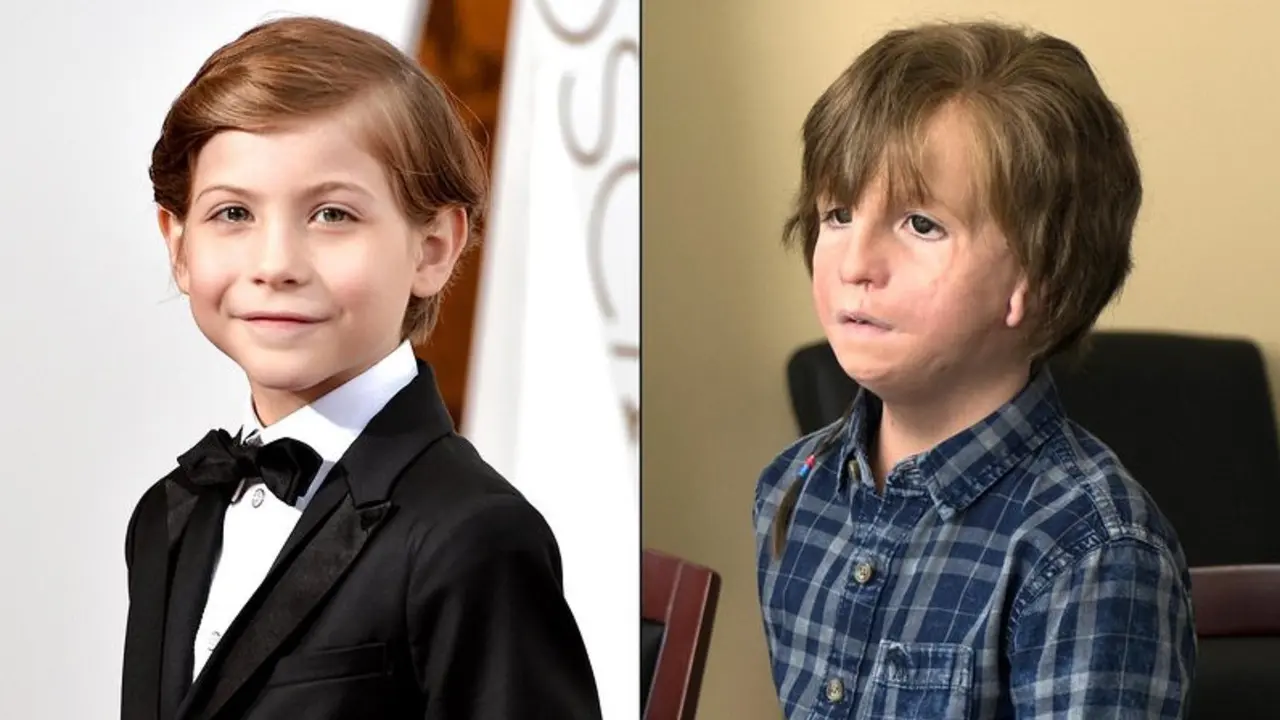 Jacob Tremblay dalam film Wonder