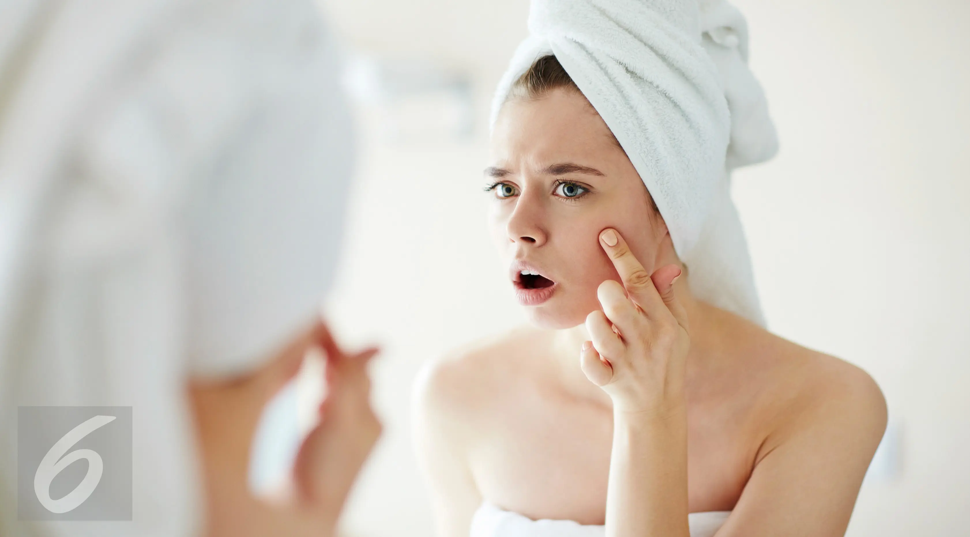 Ilustrasi: Jerawat Pada Wajah (iStockphoto)