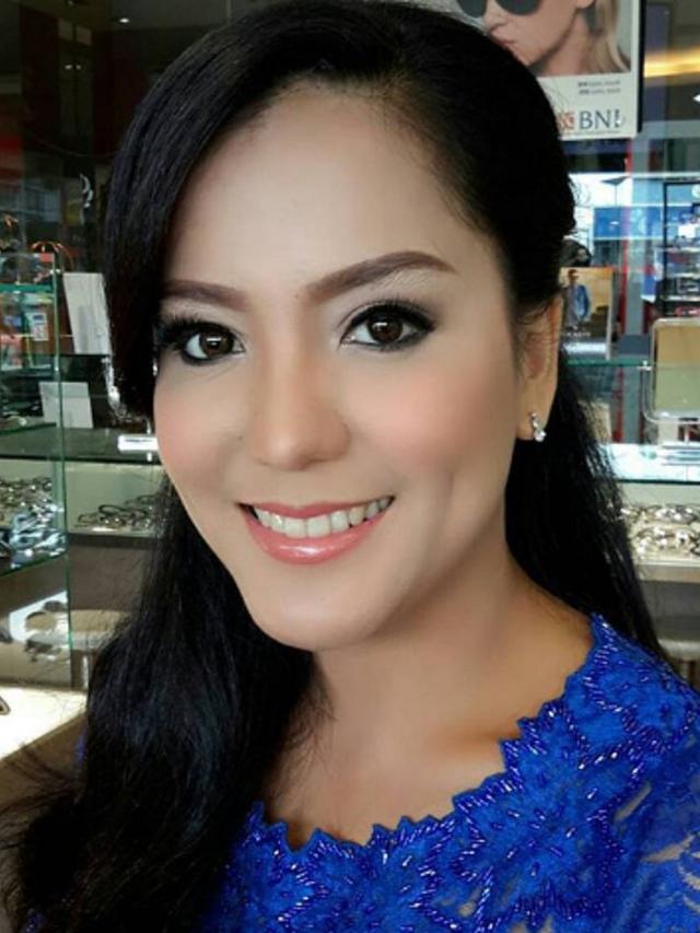 Kanker Payudara Stadium 3b Renita Sukardi Jalani Radiasi Showbiz Liputan6 Com