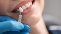 Wanita di Florida Ditangkap Usai Pasang Veneer dengan Lem Super