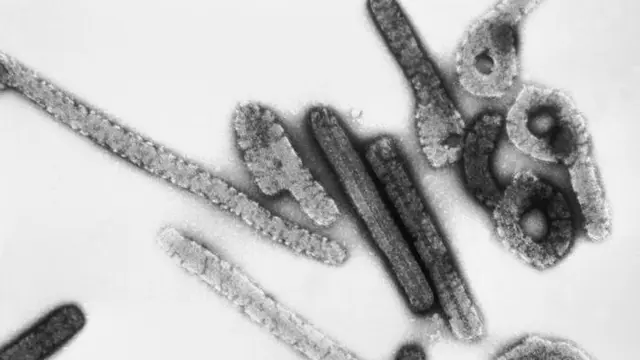 Waspada Penyakit Baru Mirip Ebola, Marburg