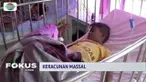 Usai menyantap kerang hijau, 10 anak di Polewali Mandar, mengalami keracunan. Meski telah dibawa ke rumah sakit, satu orang anak nyawanya tak terselamatkan.