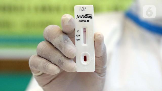 Hasil Rapid Test Corona Covid-19 di Maluku Utara, 31 Warga Terdeteksi Positif