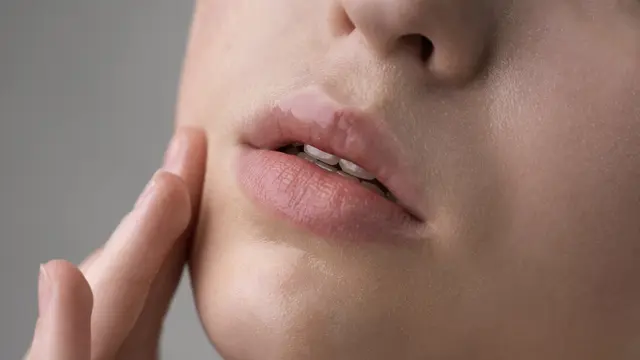 Cara Sederhana Merawat Bibir agar Lembab dan Tidak Pecah-Pecah - Cover