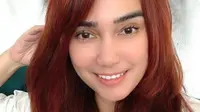 Feby Febiola Ubah Penampilan Usai Jalani Operasi