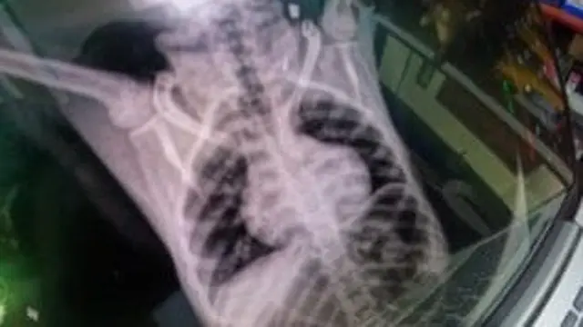 Tragis Nasib Rinja, Owa Siamang di Lampung Ditembaki 4 Peluru Senapan Angin hingga Agresif ke Warga