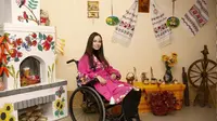 Model disabilitas Ukraina Oksana Kononets. Foto: tangkapan layar Instagram oksanakononets.