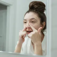 Cara Menghilangkan Chicken Skin di Wajah agar Wajah Halus