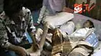 Seorang perempuan di Palu, Sulawesi Tengah, menderita penyakit aneh. Berkali-kali dibawa ke dokter, namun tak ada yang bisa mengobati penyakit Setiawati.