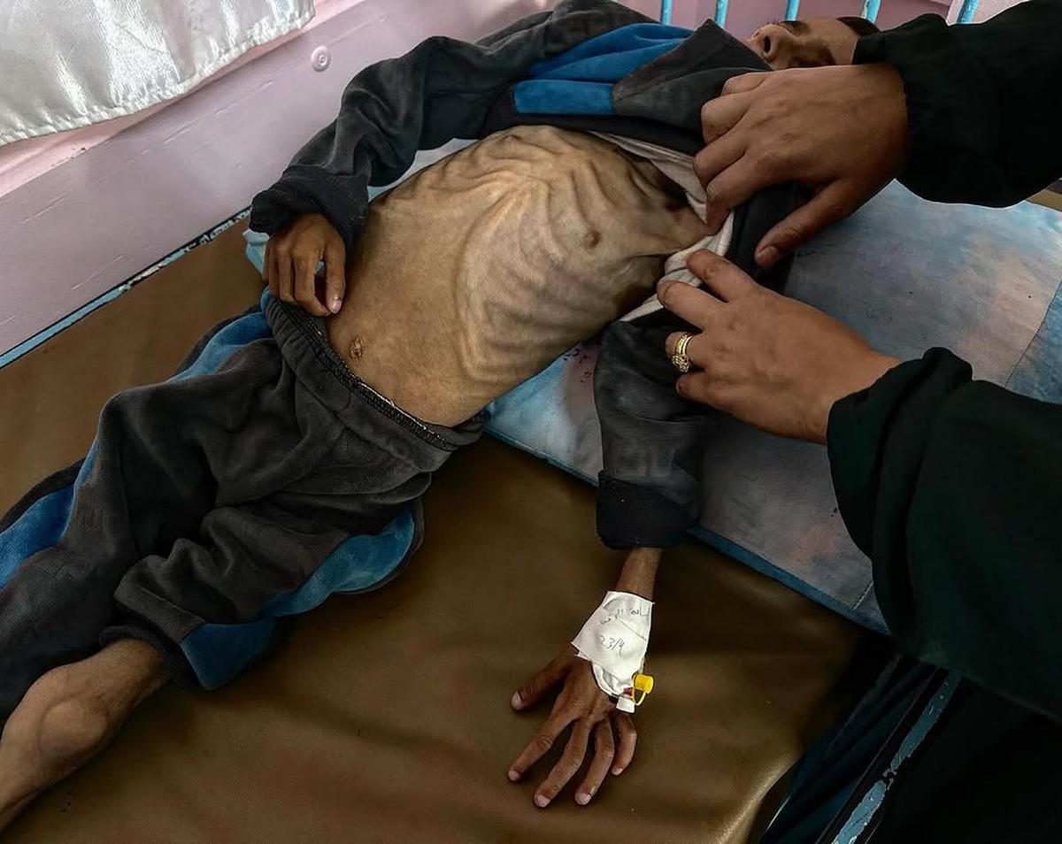 anak gaza kelaparan