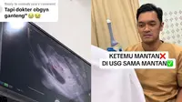 Momen canggung seorang wanita diperiksa oleh dokter Obgyn yang ternyata mantan pacarnya. (Dok: TikTok @docs.couple)