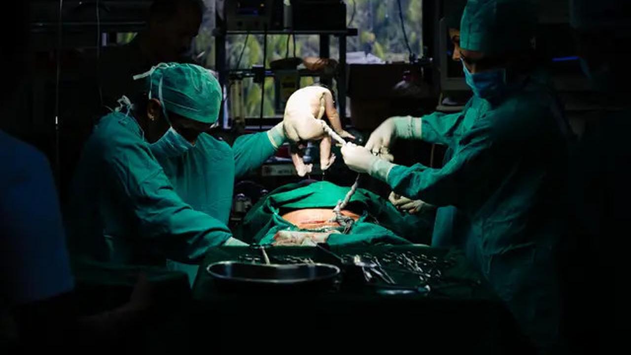 Mengeluh Sakit Perut selama 18 Tahun, Ternyata Ada Jarum di Vagina Wanita Ini