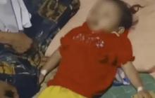 Ini Reaksi Kemenkes Bocah Raya Meninggal karena Cacing Bersarang di Tubuhnya