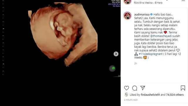 Audi Marissa (Foto: Instagram/@audimarissa)