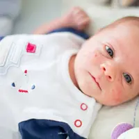 Ilustrasi bayi mengalami alergi kulit/credit: gettyimages